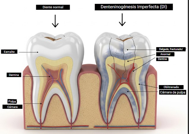 Ilustración general de las etapas de la odontogénesis